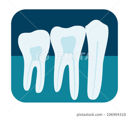 X-ray of human teeth. Three healthy molars on an x-ray. Vector illustration. X-ray of human teeth. Three healthy molars on an x-ray. Vector illustration. 106904328