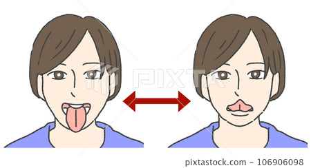 up and down movement of the tongue 106906098