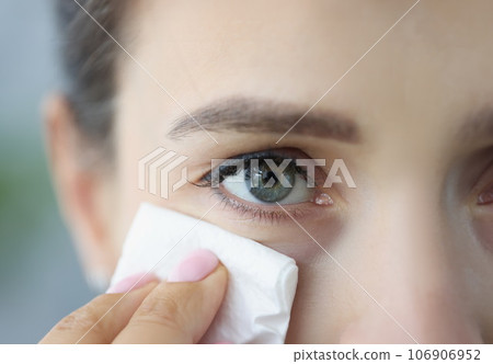 Young woman wipes face with cleaning napkin closeup 106906952