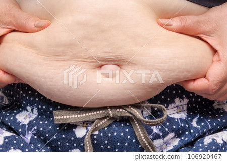 [Debeso with a housewife who picks belly meat] 106920467