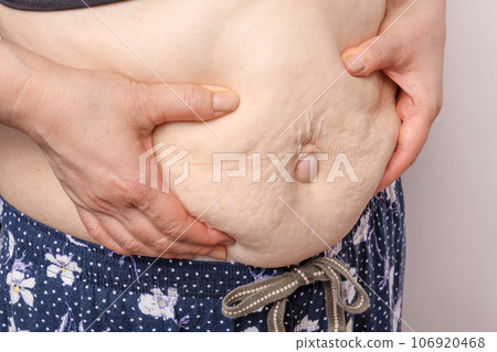 [Debeso with a housewife who picks belly meat] 106920468