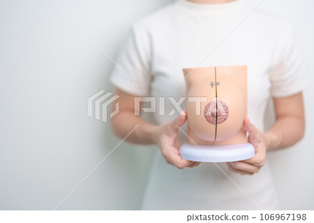 Woman holding Breast Anatomy model. Breast Augmentation Surgery, October Breast Cancer Awareness month, Pregnant, Diagnosis, Beauty woman enlargement and medical concept Woman holding Breast Anatomy model. Breast Augmentation Surgery, October Breast Cancer Awareness month, Pregnant, Diagnosis, Beauty woman enlargement and medical concept 106967198