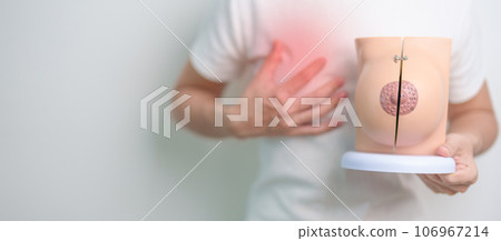 Woman holding Chest pain with Breast Anatomy model. Breast Augmentation Surgery, October Breast Cancer Awareness month, checking, Diagnosis, Beauty woman enlargement, Disease and medical concept Woman holding Chest pain with Breast Anatomy model. Breast Augmentation Surgery, October Breast Cancer Awareness month, checking, Diagnosis, Beauty woman enlargement, Disease and medical concept 106967214