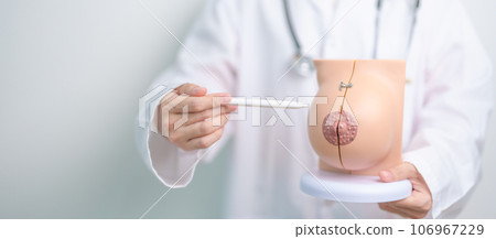 Doctor holding Breast Anatomy model. Breast Augmentation Surgery, October Breast Cancer Awareness month, implant, Diagnosis, Beauty woman enlargement and medical education concept 106967229