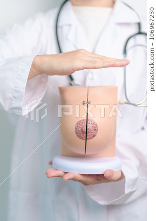 Doctor hand cover Breast Anatomy model. Breast Augmentation Surgery, October Breast Cancer Awareness month, implant, Diagnosis, Beauty woman enlargement and medical education concept 106967230