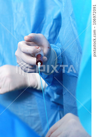 Endovascular surgery. Surgery on blood vessels. Surgical interventions on blood vessels.Concept of healthcare.Vertical photo. 106972091