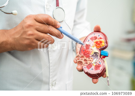 Kidney disease, Chronic kidney disease ckd, Doctor hold model to study and treat in hospital. Kidney disease, Chronic kidney disease ckd, Doctor hold model to study and treat in hospital. 106973089