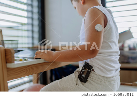 The diabetic boy doing homework, while wearing a continuous glucose monitoring sensor on his arm. The diabetic boy doing homework, while wearing a continuous glucose monitoring sensor on his arm. 106983011