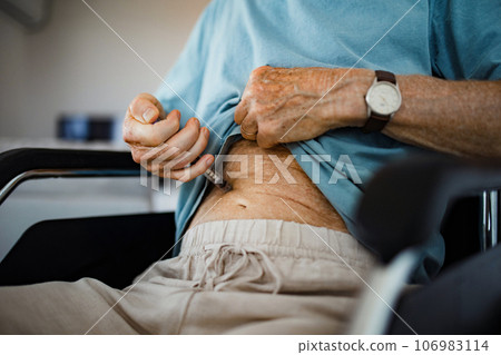 Diabetic senior patient injecting insulin in his belly. 106983114