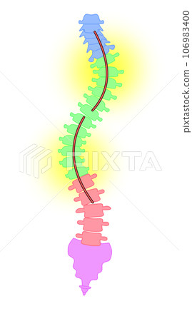 A simple illustration of a scoliotic spine 106983400