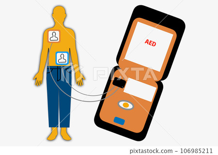 自動體外去顫器AED 106985211