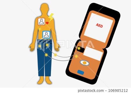 automatic external defibrillator AED automatic external defibrillator AED 106985212