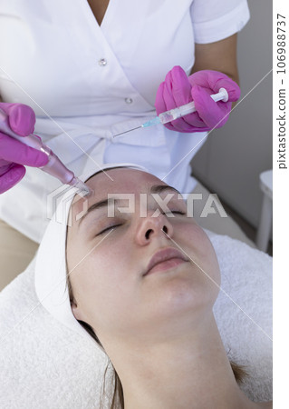 Cosmetologist Applying Peeling For Mesotherapy Injection With Dermapen On Face, Forehead Area Of Young Woman For Rejuvenation In Spa Saloon. Patient Getting Needle Mesotherapy, Skincare. Vertical. 106988737