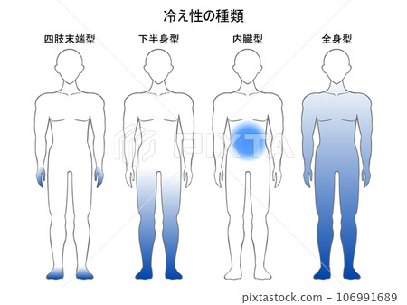 List of types of sensitivity to cold 106991689