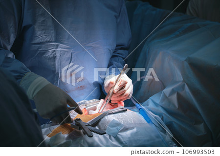 Closeup of doctors hands operating a patient conducting open cut surgery in surgical room. Healthcare and medical intervention concept Closeup of doctors hands operating a patient conducting open cut surgery in surgical room. Healthcare and medical intervention concept 106993503