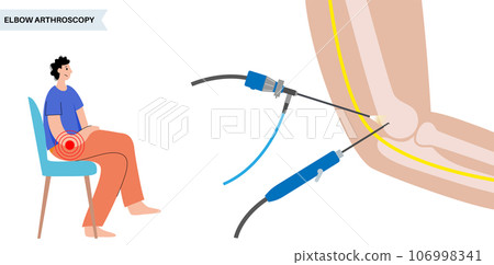 Elbow arthroscopy surgery 106998341