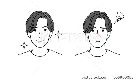 一個為毛孔煩惱的男人和一個解決問題後微笑的男人 106999893