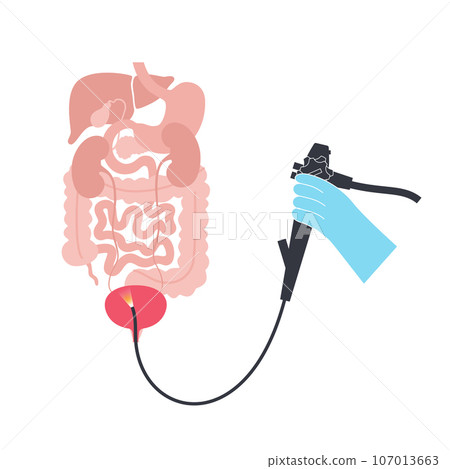 Cystoscopy examination concept Cystoscopy examination concept 107013663