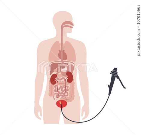 Cystoscopy examination concept 107013665