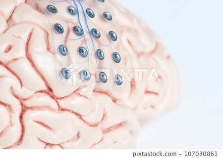 Subdural grid electrode for brain waves recording on the brain model 107030861