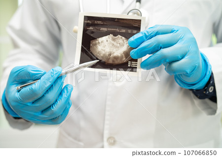 Uterus and ovary, doctor holding anatomy model and ultrasound picture for study diagnosis and treatment in hospital. 107066850