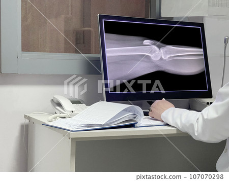 Doctor Examining Knee X-ray In Clinic Doctor Examining Knee X-ray In Clinic 107070298