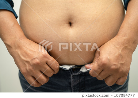 Overweight Asian woman show and use hand to squeeze fat belly. 107094777