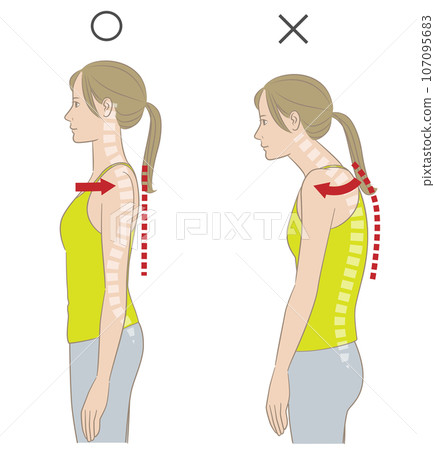 A woman with good posture and a woman with rolled shoulders and a stooped back 107095683