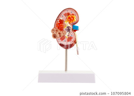 Kidney model isolated on white background with clipping path. Chronic kidney disease, treatment urinary system, urology, Estimated glomerular filtration rate eGFR. Kidney model isolated on white background with clipping path. Chronic kidney disease, treatment urinary system, urology, Estimated glomerular filtration rate eGFR. 107095804