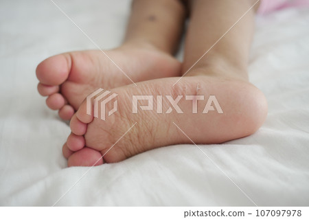 close up of dry child feet on bed , 107097978