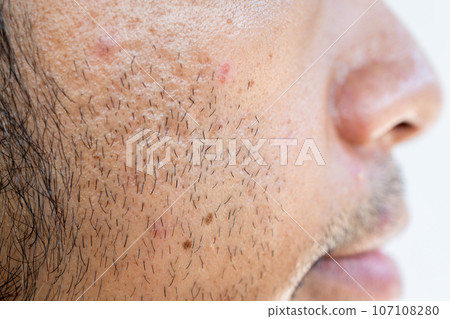 Side view of facial hair grown on men's cheek. Facial hair is hair grown on the face. Side view of facial hair grown on men's cheek. Facial hair is hair grown on the face. 107108280
