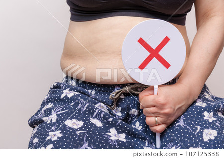 [Stomach and plate of a housewife with metabolic syndrome] 107125338