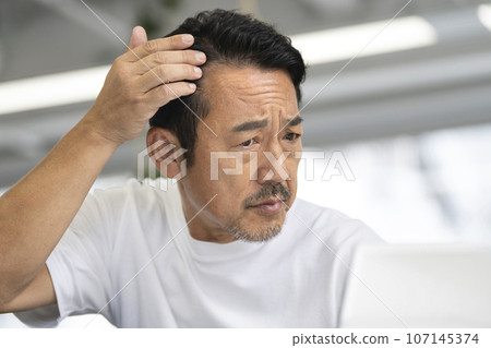 A man in his 50s who is concerned about the hairline on his forehead A man in his 50s who is concerned about the hairline on his forehead 107145374