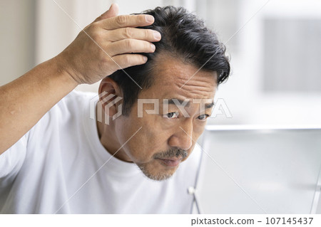 A man in his 50s who is concerned about the hairline on his forehead 107145437