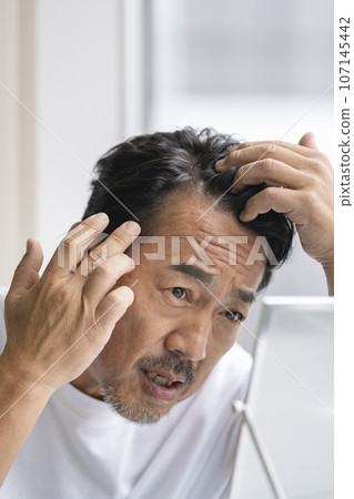 A man in his 50s who is concerned about the hairline on his forehead A man in his 50s who is concerned about the hairline on his forehead 107145442