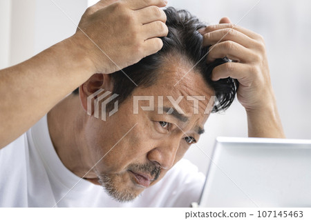 A man in his 50s who is concerned about the hairline on his forehead 107145463