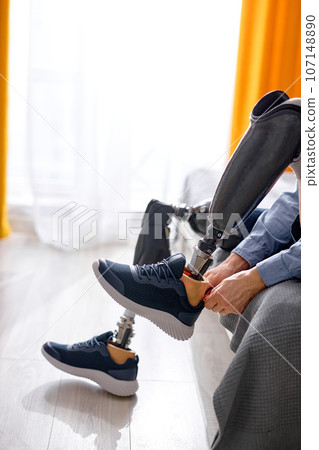 rehabilitation after leg amputation, cropped guy getting used to prosthesis on legs 107148890