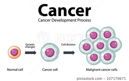 Processing of Cancer Cells: An Infographic Exploration 107170671