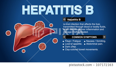 Symptoms of Hepatitis B Infographic 107172163