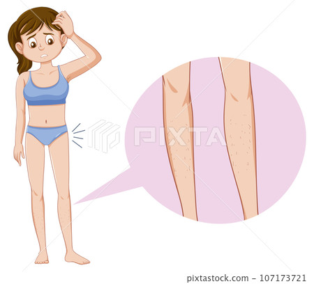 Teen Girl Experiencing Puberty Concept Teen Girl Experiencing Puberty Concept 107173721
