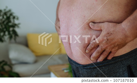 Close-up shot of an obese man holding his belly. Close-up shot of an obese man holding his belly. 107187010