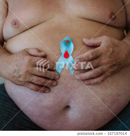 Overweight man holding a blue diabetes support ribbon as a symbol of diabetes awareness. 107187014