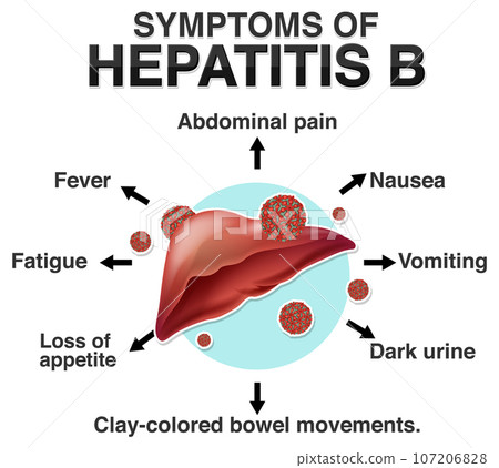 Informative symptoms of Hepatitis B Informative symptoms of Hepatitis B 107206828
