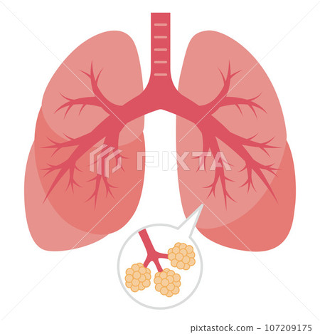 Illustration of the lungs Illustration of the lungs 107209175