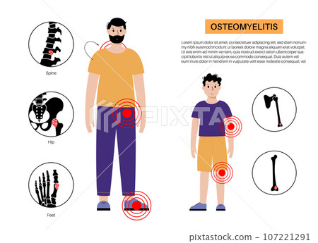 Osteomyelitis children and adults 107221291