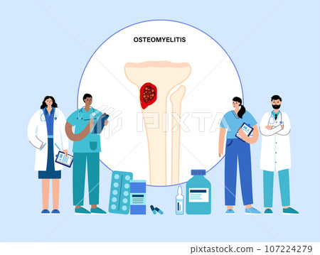 Tibia bone osteomyelitis Tibia bone osteomyelitis 107224279