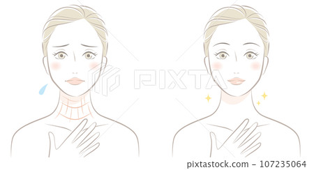 Before and after of a woman suffering from neck wrinkles 107235064