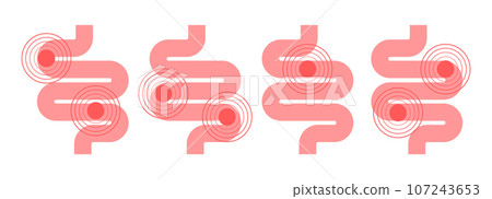 Set of stomach images with problems. Hypersensitivity to components of the food Set of stomach images with problems. Hypersensitivity to components of the food 107243653