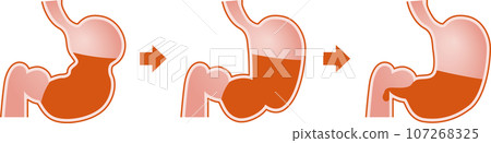 胃蠕動圖 107268325