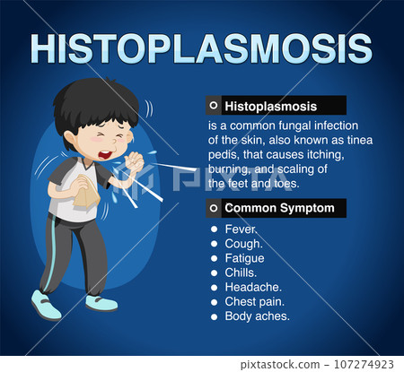 Informative poster of Histoplasmosis 107274923